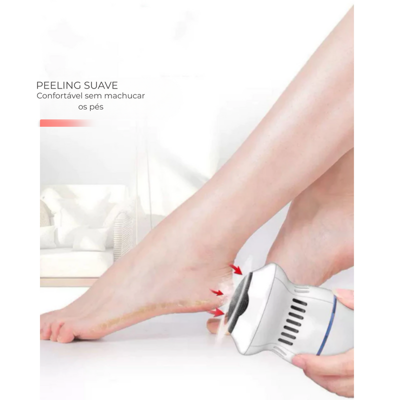 Removedor de calos e rachaduras Beauty Feet